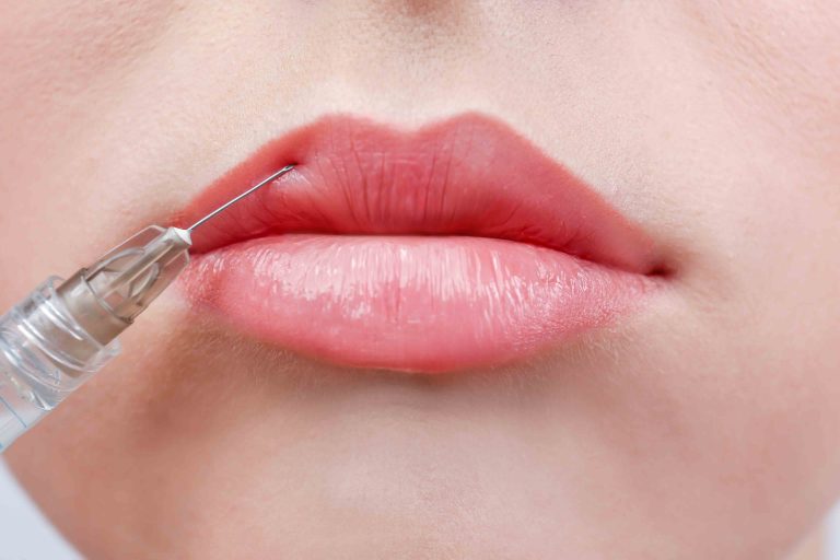 Botox Lip Flip Near Me: Is It Worth the Cost?