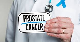 PROSTATE CANCER, CAUSES, SYMPTOMS AND TREATMENT
