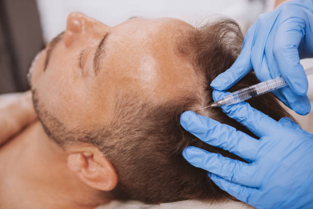 How to Find the Best PRP Clinic for Your Hair Loss Needs
